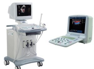 doppler-scan-center-in-neyveli-sns-hospital