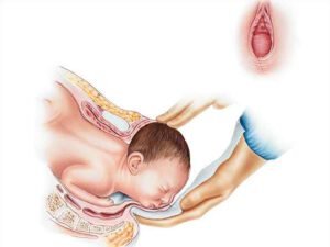 normal-delivery-ward-in-neyveli-sns-hospital