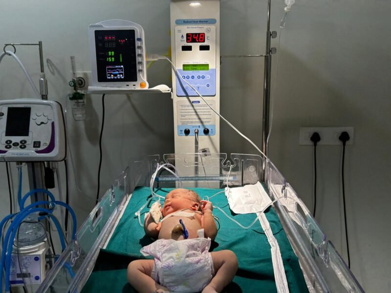 NEW BORN ICU