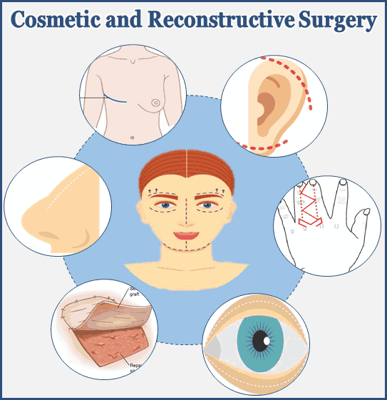 Reconstructive Surgery